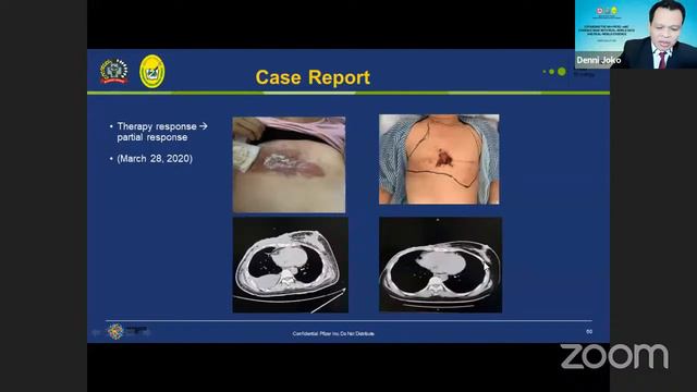 Webinar Oncology Expert Sharing смотреть онлайн