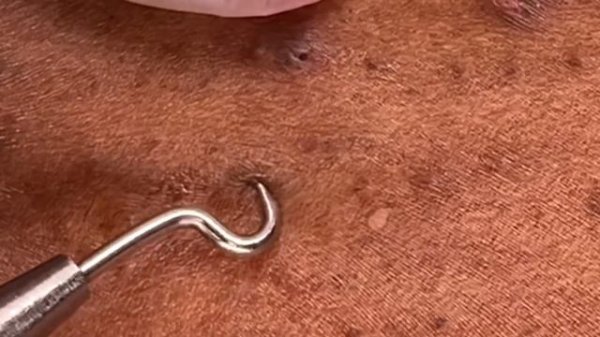 Urban extraction Episode 79