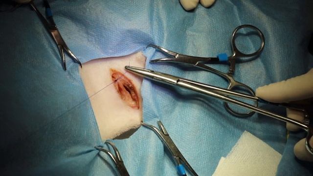 Submandibular lymph node resection in a dog смотреть онлайн