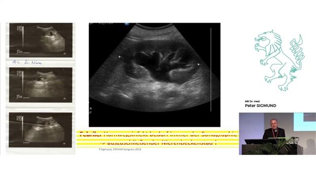 Sonographie in der Allgemeinmedizin смотреть онлайн