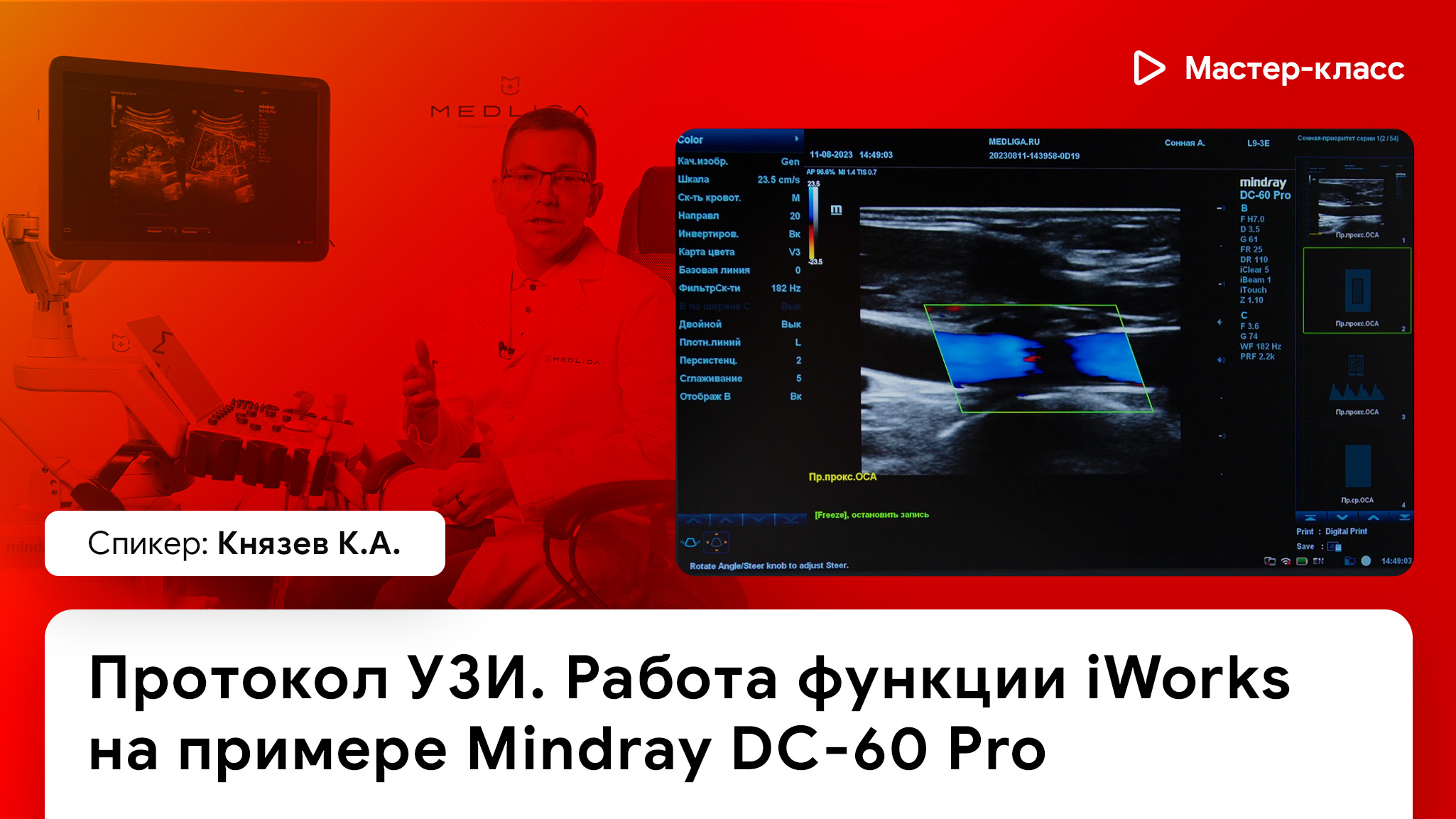 Протокол УЗИ. Работа функции iWorks на примере Mindray DC-60 Pro