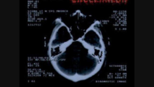 Encephalon - "Encephalopathy" смотреть онлайн