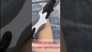 ELOS Эпиляция. Как это работает!