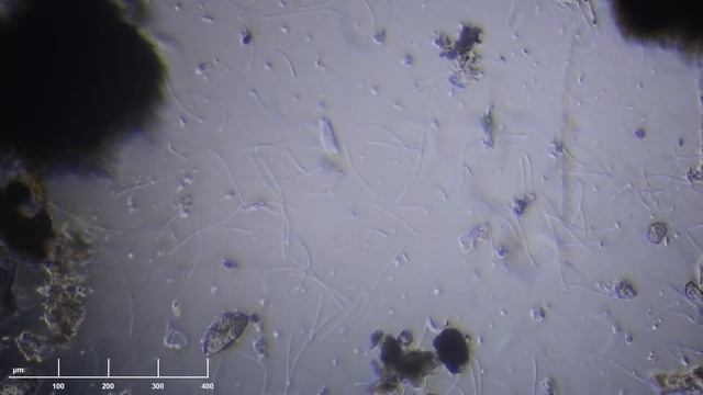 Filamentous Bacteria смотреть онлайн