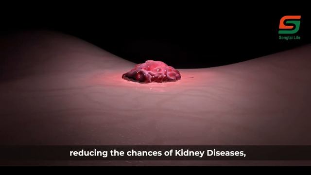 Songtai Life Ganoderma Lucidum Spore Capsules (King of Herbs) смотреть онлайн