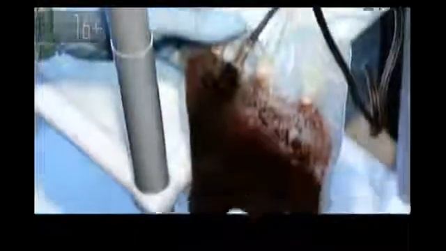 Печень - самый удивительный орган, человека! смотреть онлайн