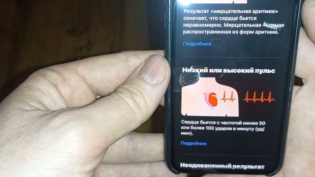 Apple Watch Ultra как настроить Экг кардиограмму И пульс определении аритмии смотреть онлайн