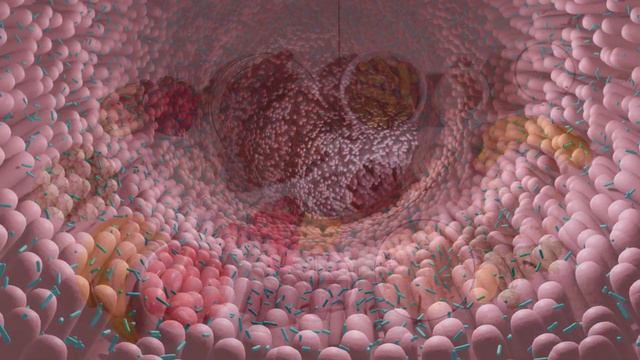 EL SIROPE DE ARCE - Propiedades y Dieta смотреть онлайн