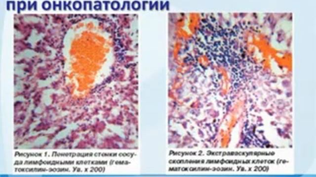 presentation GA 40 смотреть онлайн