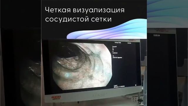Гастроскопия и колоноскопия экспертного класса