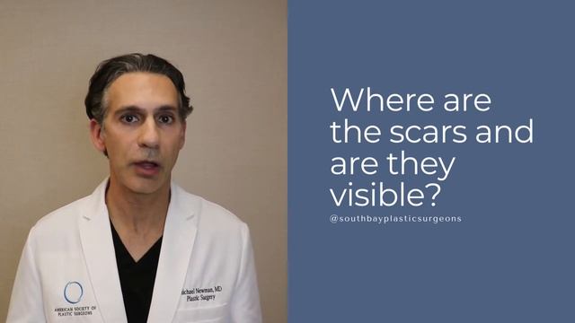 Commonly Asked Facelift Questions with Dr. Newman смотреть онлайн