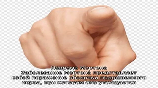 Почему опух палец на ноге смотреть онлайн