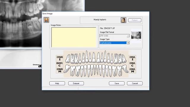 VixWin Platinum 3.5 - Acquiring Images in the Windows Layout View смотреть онлайн
