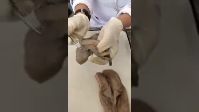 Для СТУДЕНТОВ!!! Женская половая система.Наружные и внутренние женские половые органы. смотреть онлайн