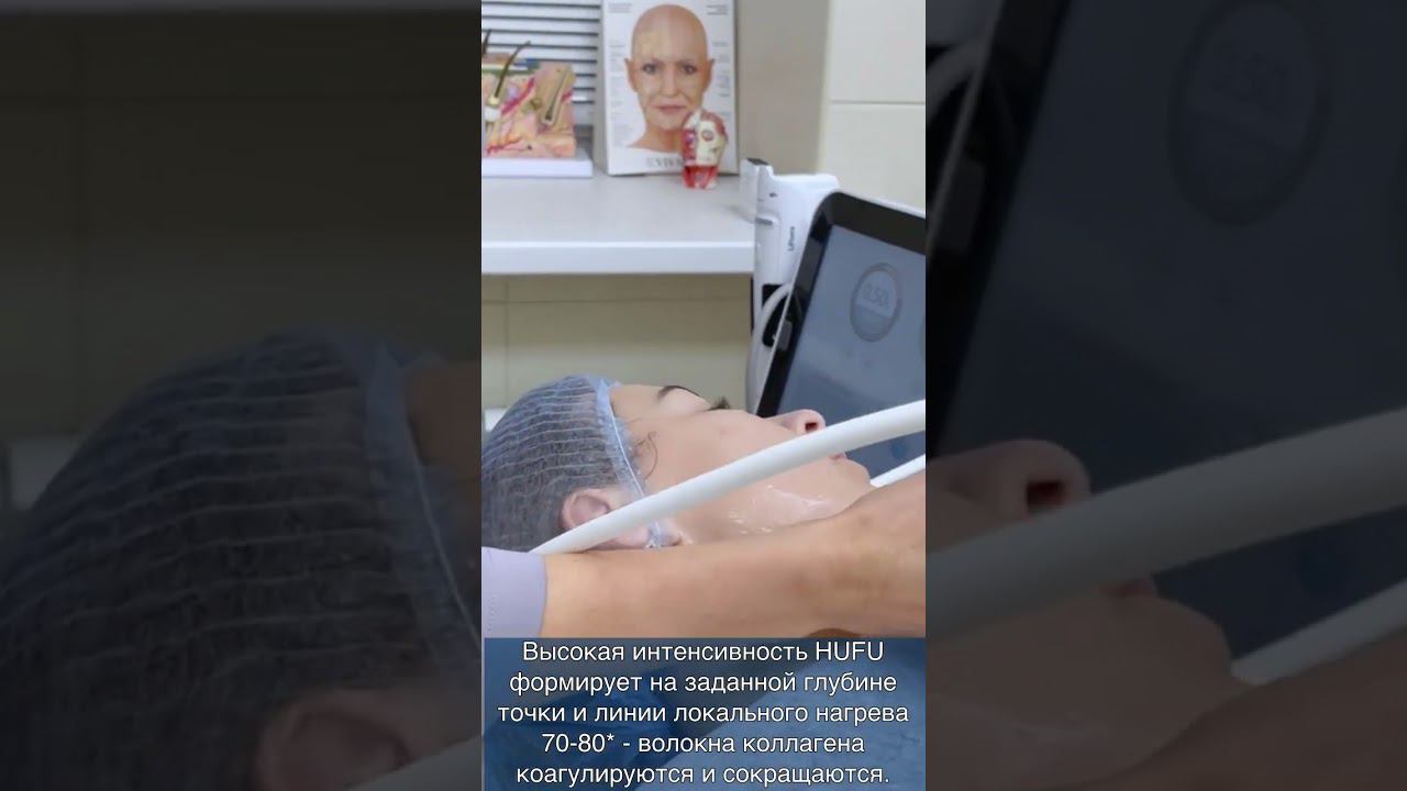 СМАС-лифтинг лица #допосле в конце ролика! смотреть онлайн