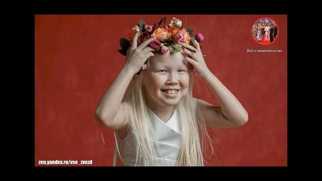 Как сейчас живёт Сибирская Белоснежка, как повзрослела девочка с нестандартной внешностью. Ей ско.. смотреть онлайн