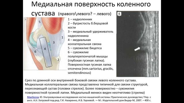 Ультразвуковая анатомия коленного сустава смотреть онлайн
