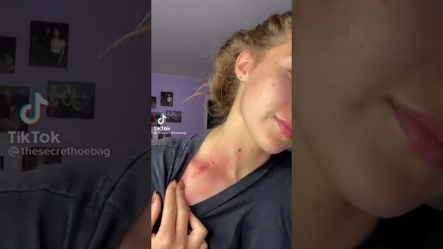 лайфхак как быстро избавиться от засоса смотреть онлайн