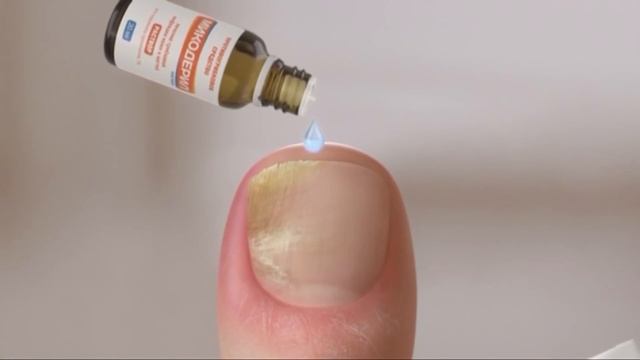 (2016) МИКОДЕРИЛ - С грибком справляться научил МИКОДЕРИЛ смотреть онлайн