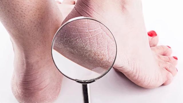 Пятки как у младенца | Как сделать пятки гладкими в домашних условиях | Маски для пяток смотреть онлайн