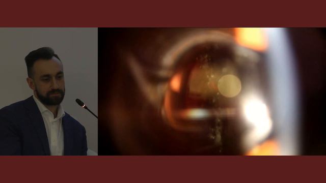 NEW ERA live: Лазерное лечение помутнений стекловидного тела смотреть онлайн