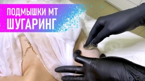 Шугаринг подмышечных впадин - мануальная техника.