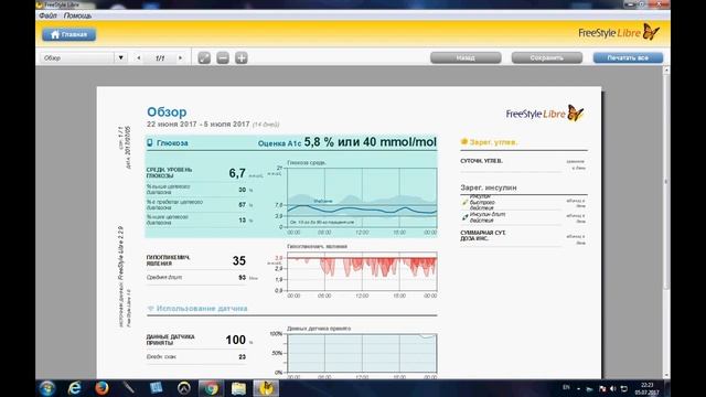 FreeStyle Libre. Софт для выгрузки данных и построения отчетов. Теперь открыт для РФ! смотреть онлайн