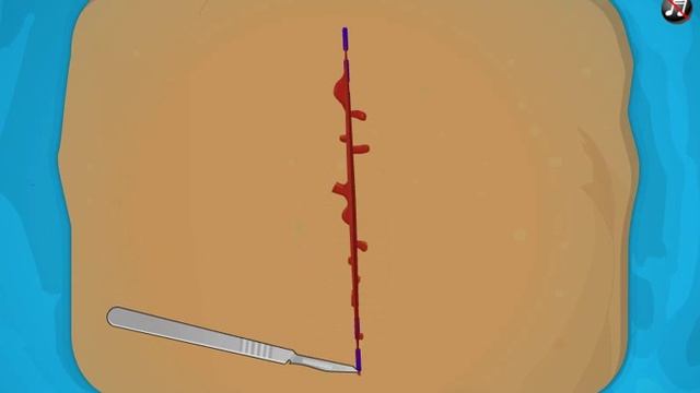 Operate Now: Pacemaker Surgery GaMe смотреть онлайн