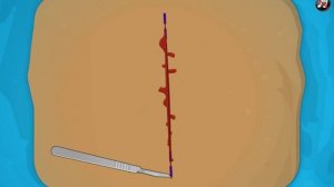 Operate Now: Pacemaker Surgery GaMe