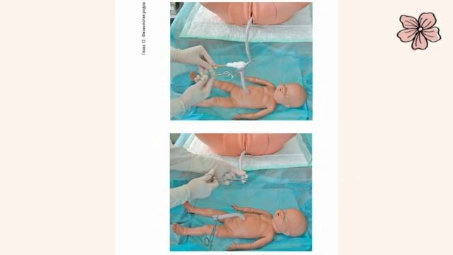 Первичная обработка пуповины смотреть онлайн