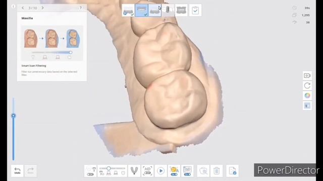 Steps of how to Scan for an Implant Crown Using an Intraoral Scanner Medit i700 and Medit link смотреть онлайн
