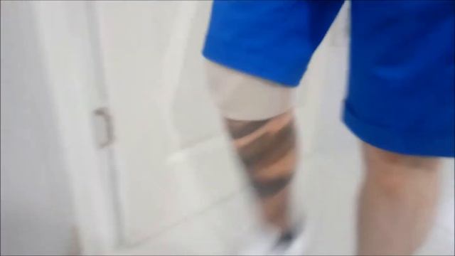 Custom cover for TT prosthesis смотреть онлайн