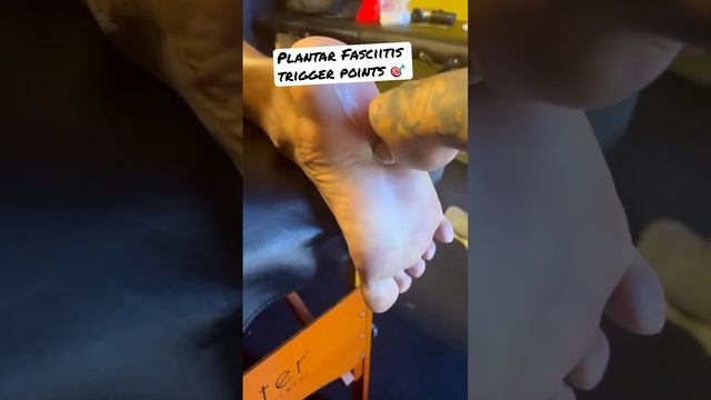 NO MORE Plantar fasciitis, TriggerPoints for Foot Pain ?? #footpain #plantarfasciitis смотреть онлайн