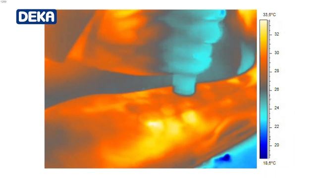 Deka Motus Moveo AX Alexandrite Laser смотреть онлайн