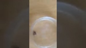 Лучшее средство от клещей своими руками.