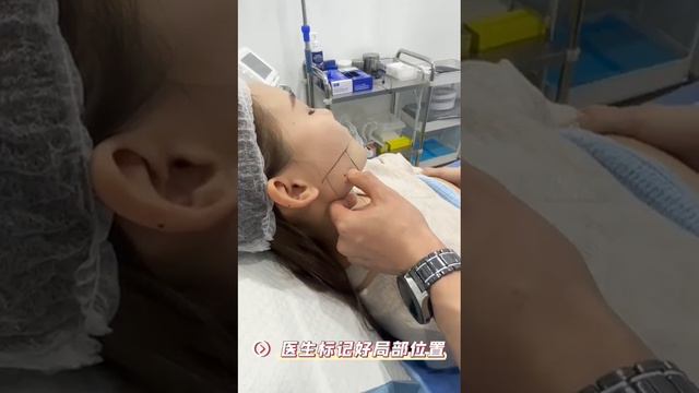 Face slimming, one of the method of achieving V-shape face. смотреть онлайн
