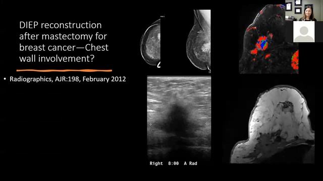 Basic Breast MRI Interpretation смотреть онлайн