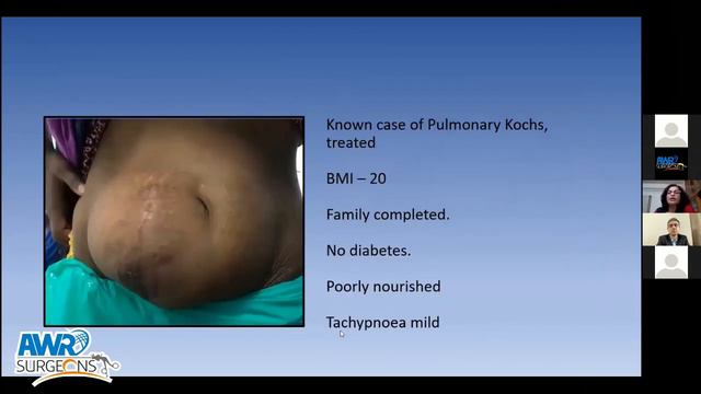 Practical look at AWR - Abbott India and AWRSC смотреть онлайн