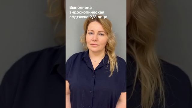 1,5 года после пластики лица! Совершенно другой человек ? Пластический хирург Христенко А.А. смотреть онлайн