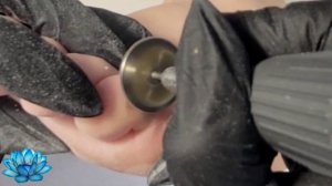 Аппаратный педикюр. Как обработать натоптыши на стопе и удалить мозоли на ногах.