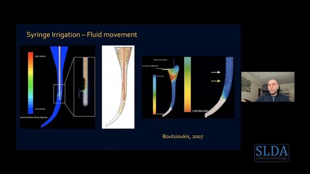 Irrigation, irrigation, irrigation: the secret to endodontic success смотреть онлайн