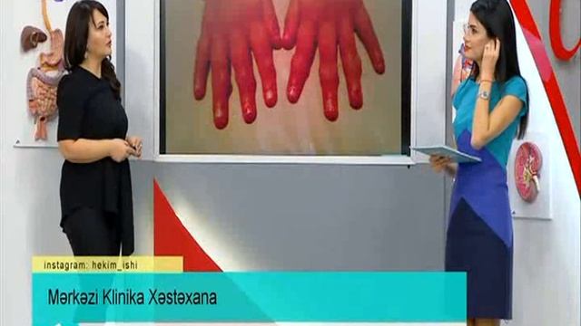 Pediatr-revmatoloq - Dr.Sevda Mustafayeva, Merkezi Klinika смотреть онлайн