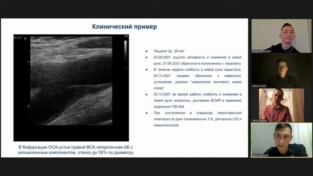 Роль УЗИ брахиоцефальных артерий в диагностике и лечении пациентов с ишемическим инсультом и ТИА смотреть онлайн