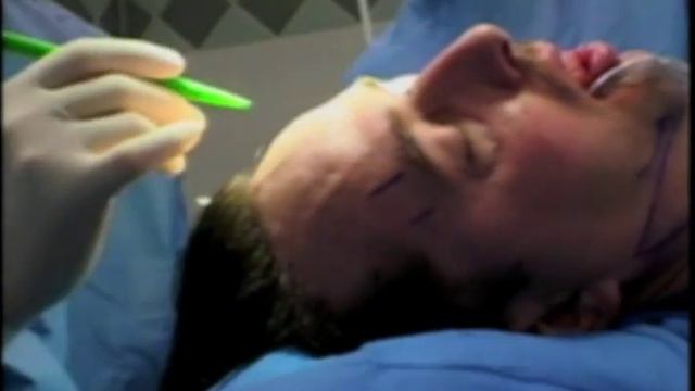 Extreme Makeover | Dr. Garth Fisher Performs a Brow Lift, Nose Job and Eye Lift on David Patteson смотреть онлайн