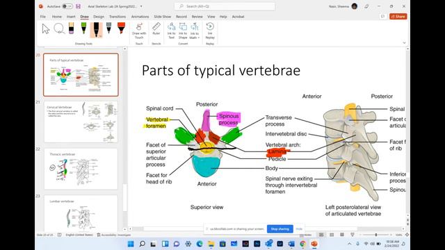 Axial Skeleton - Part 3 - (Sternum, Ribs, Vertebrae)