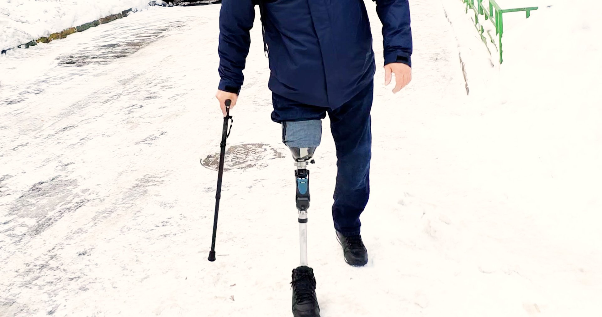 Коленный модуль "NK6 “Symphony" - рассказ пользователя протезов. смотреть онлайн