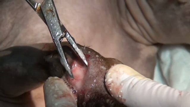 СФИНКС. Остеосинтез пястных костей SPHINX. Osteosynthesis Metacarpals