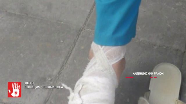 Челябинку чуть не загрызла собственная собака смотреть онлайн