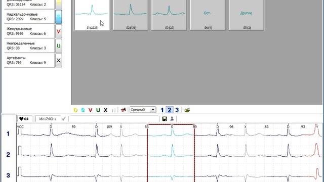 Комплекс Суточного Мониторирования ЭКГ по Холтеру "Эксперт-Холтер" смотреть онлайн