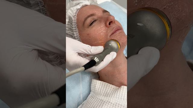 Ультразвуковой лифтинг Skinova Pro - безоперационная подтяжка лица | сеть клиник косметологии GEN87 смотреть онлайн